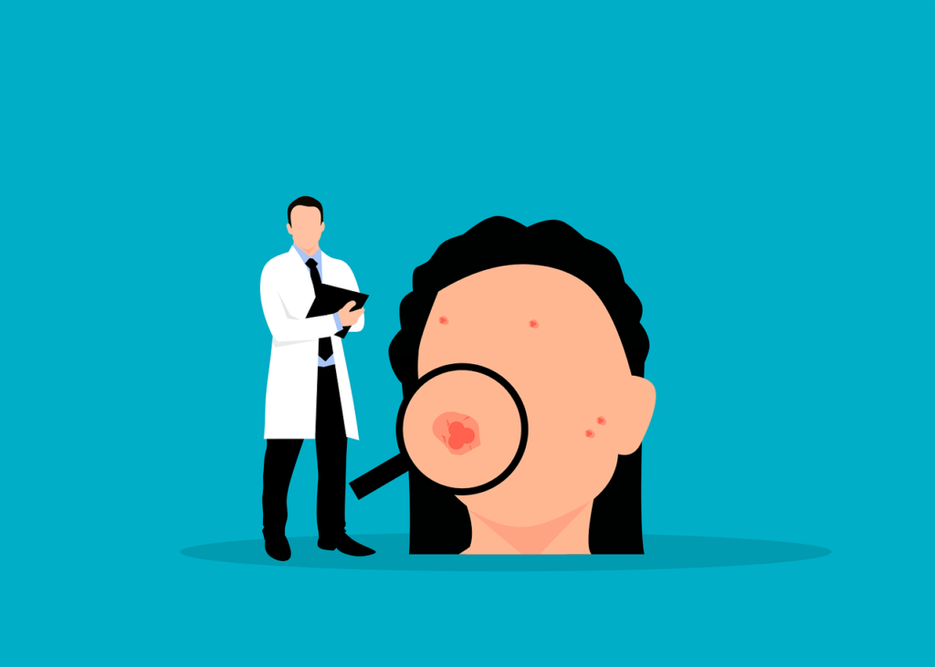 Consulta professional tractament acne